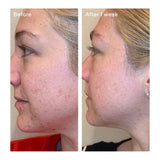 Murad Daily Clarifying Peel