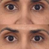 Murad x Dr. Zion Retinol Youth Renewal Eye Masks