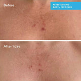 Murad Blemish Control Retexturizing Body Pads