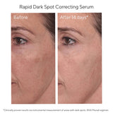 Murad Rapid Dark Spot Correcting Serum