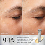 Crystal Retinal Ceramide Eye 6