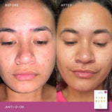 Vida Glow Anti-G-Ox Berry