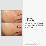 Murad Clarifying Water Gel