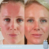 Vida Glow Clear Advanced Repair