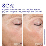 iS Clinical Active Peel System