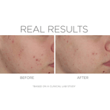 Cosmedix Shineless Oil Free Moisturiser