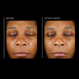 PCA Skin Hyaluronic Acid Overnight Mask