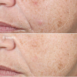 Dermalogica Active Clearing Retinol Clearing Oil